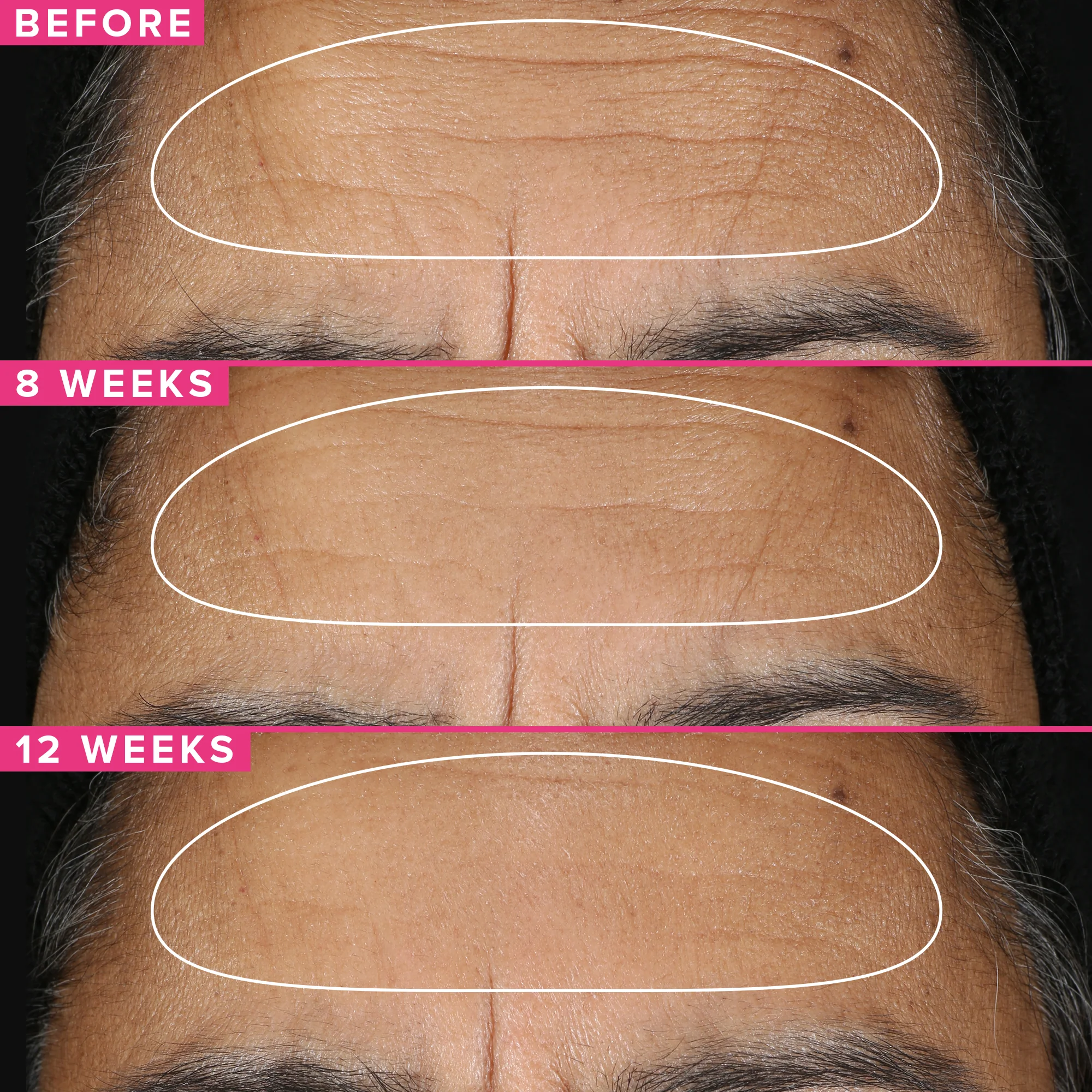 1% Vitamin A Retinol Serum - Image 5